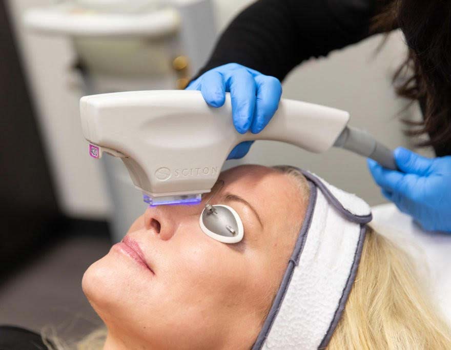 BBL Broadband Light Therapy at Glow Dermspa