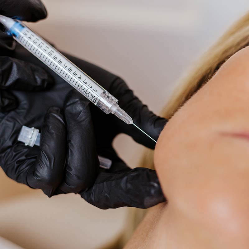 Radiesse Filler Injection during Facial Treatment at Glow Dermspa in Lakewood Ranch Florida