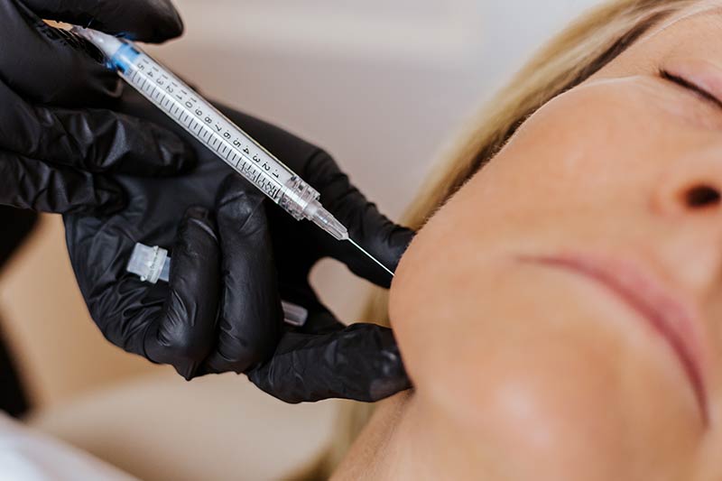 Radiesse Filler Injection during Facial Treatment at Glow Dermspa in Lakewood Ranch Florida